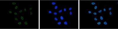 Immunofluorescence: Histone H3 [ac Lys27] Antibody [NBP2-59225] - HeLa cells were stained with the antibody against H3K27ac and with DAPI. Cells were fixed with 4% formaldehyde for 10' and blocked with PBS/TX-100 containing 5% normal goat serum and 1% BSA. The cells were immunofluorescently labelled with the H3K27ac antibody (left) diluted 1:500 in blocking solution followed by an anti-rabbit antibody conjugated to Alexa Fluor 488. The middle panel shows staining of the nuclei with DAPI. A merge of the two stainings is shown on the right.